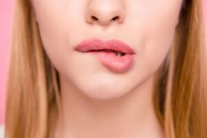 Skin Biting Disorder – Excoriation Disorder(ED)