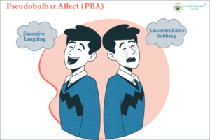 Pseudobulbar Affect